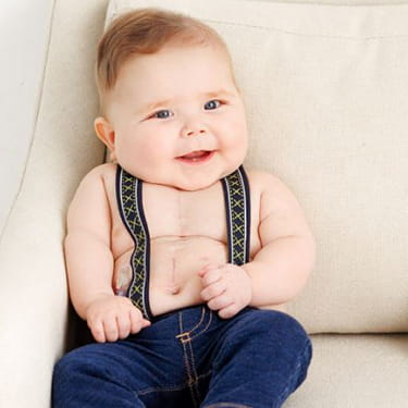 Dylan, a patient of Cincinnati Children's Heart Institute.