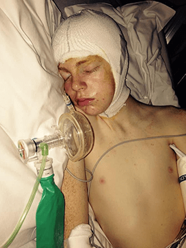 Tyler in hospital after surgery.