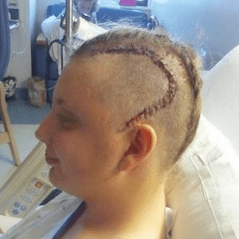 Zoe in hospital after surgery.