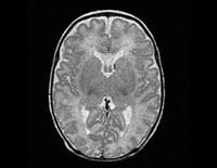 MRI for newborns at Cincinnati Children's.