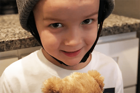 An image of a patient with a pilocytic astrocytoma of the cerebellum.