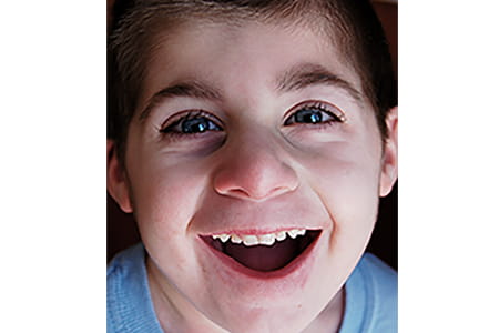 Photo of Jason, and RTS patient.