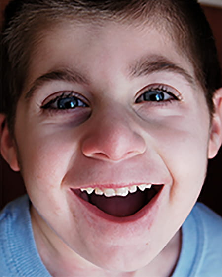 A photo of an RTS patient.