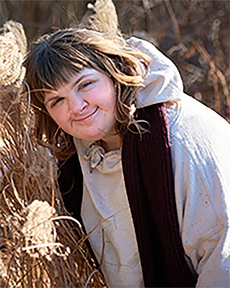 A photo of an RTS patient outside.