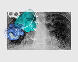 Imaging from the Hybrid OR.