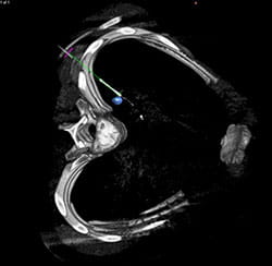 Imaging from the Hybrid OR.