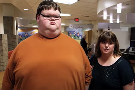 A photo of Jacob before surgical weight loss.