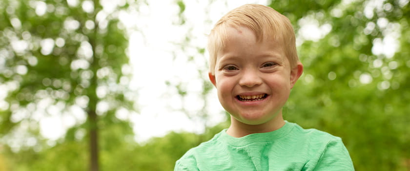 An image of a Down syndrome patient.