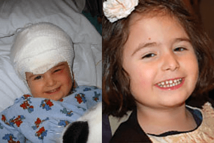 Tuberous sclerosis patient, Frannie Schmidt.