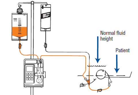 continuous tube feeding change bag