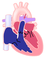 heart pro app ductus arteriosus heart pro app ductus arteriosus
