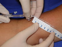double lumen picc line flush double lumen picc line flush