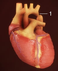 heart pro app ductus arteriosus heart pro app ductus arteriosus