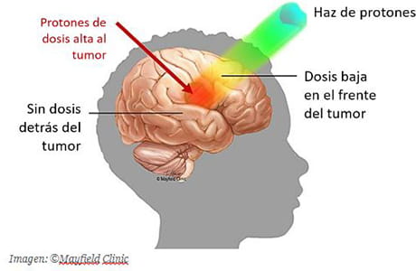 proton radiation spanish