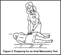 Anal Manometry