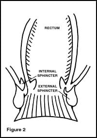 Anal Manometry