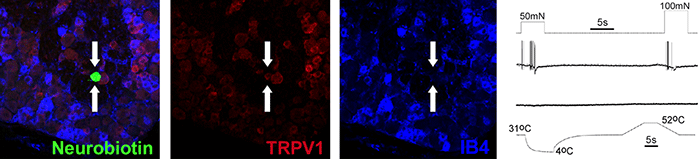 Retrogradely labeled afferents in the dorsal root ganglion. 