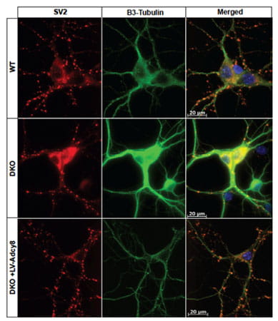 Adenylyl cyclase type 8 regulates SV2 expression. Shown are representative images of SV2 distribution in cultured hippocampal neurons.  SV2 is labeled with CY3 (red). β3-tubulin, a neuronal marker, is labeled with Alexa 488. Dapi is used to visualize nuclei. SV2 is reduced in DKO cultures, but not DKO cultures infected with Lentivirus-Adcy8.