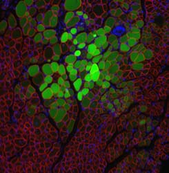 Figure 2: Cell engraftment by Green Fluorescent Protein-positive myoblasts into muscle fibers detected 4 weeks following transplantation at 5 days post-neonatal denervation.