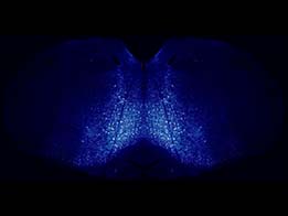Figure 2: V2a neurons in the medial reticular formation of the brainstem are fluorescently labeled in transgenic mice. V2a neurons are important for driving motor behaviors such as locomotion and breathing.