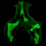 Early Lung Specification and Morphogenesis.