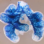 Epithelial-to-Mesenchymal Signaling Mechanisms.